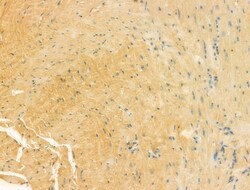 Invitrogen UQCRFS1 Polyclonal Antibody 100 &mu;L; Unconjugated:Antibodies,