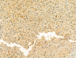 Invitrogen UQCRFS1 Polyclonal Antibody 100 &mu;L; Unconjugated:Antibodies,
