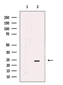 Invitrogen UQCRFS1 Polyclonal Antibody 100 &mu;L; Unconjugated:Antibodies,