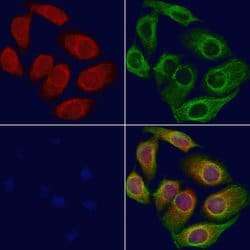 Invitrogen BBS7 Polyclonal Antibody 100 &mu;L; Unconjugated:Antibodies,
