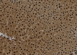 Invitrogen Centrin 2 Polyclonal Antibody 100 &mu;L; Unconjugated:Antibodies,