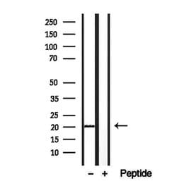 Invitrogen Centrin 2 Polyclonal Antibody 100 &mu;L; Unconjugated:Antibodies,
