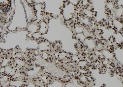 Invitrogen CEP164 Polyclonal Antibody 100 &mu;L; Unconjugated:Antibodies,