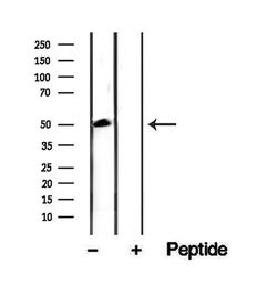 Invitrogen CKMT1A Polyclonal Antibody 100 μL; Unconjugated:Antibodies,
