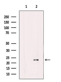 Invitrogen COQ7 Polyclonal Antibody 100 &mu;L | Buy Online | Invitrogen&trade; | Fisher Scientific