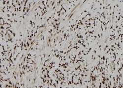Invitrogen CPSF4 Polyclonal Antibody 100 μL; Unconjugated:Antibodies,