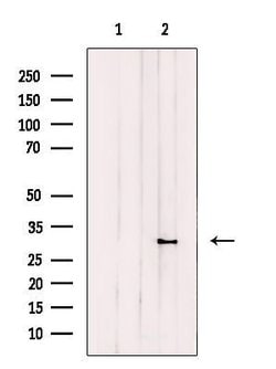 Invitrogen CPSF4 Polyclonal Antibody 100 μL; Unconjugated:Antibodies,