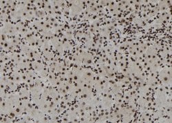 Invitrogen DHX38 Polyclonal Antibody 100 &mu;L; Unconjugated:Antibodies,