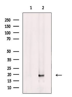 Invitrogen FAM96B Polyclonal Antibody 100 μL; Unconjugated:Antibodies,