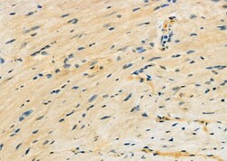 Invitrogen FECH Polyclonal Antibody 100 &mu;L; Unconjugated:Antibodies,