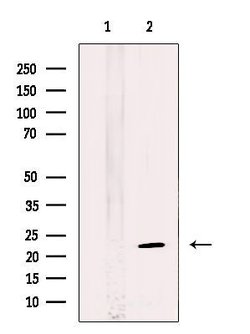Invitrogen LAMTOR5 Polyclonal Antibody 100 &mu;L; Unconjugated:Antibodies,