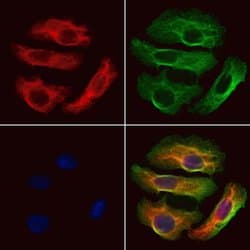 Invitrogen HBE1 Polyclonal Antibody 100 &mu;L; Unconjugated:Antibodies,