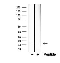 Invitrogen HBE1 Polyclonal Antibody 100 &mu;L; Unconjugated:Antibodies,
