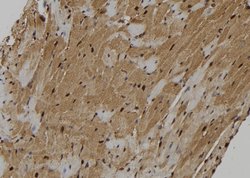 Invitrogen KIF18A Polyclonal Antibody 100 &mu;L; Unconjugated:Antibodies,
