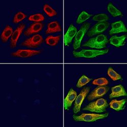 Invitrogen KIFC3 Polyclonal Antibody 100 μL; Unconjugated:Antibodies,