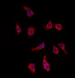Invitrogen KIFC3 Polyclonal Antibody 100 μL; Unconjugated:Antibodies,