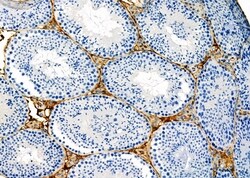 Invitrogen KIFC3 Polyclonal Antibody 100 μL; Unconjugated:Antibodies,