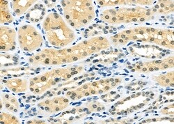 Invitrogen MAD2L2 Polyclonal Antibody 100 &mu;L; Unconjugated:Antibodies,