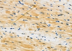 Invitrogen Mast Cell Chymase Polyclonal Antibody 100 &mu;L; Unconjugated:Antibodies,