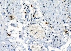 Invitrogen Mast Cell Chymase Polyclonal Antibody 100 &mu;L; Unconjugated:Antibodies,