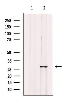 Invitrogen Mast Cell Chymase Polyclonal Antibody 100 &mu;L; Unconjugated:Antibodies,