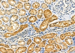 Invitrogen MLXIP Polyclonal Antibody 100 μL; Unconjugated:Antibodies,