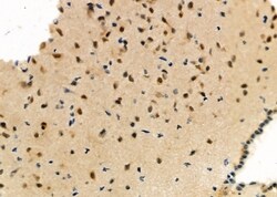 Invitrogen MYO18A Polyclonal Antibody 100 &mu;L; Unconjugated:Antibodies,