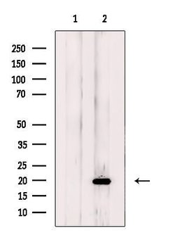Invitrogen NDUFB11 Polyclonal Antibody 100 μL; Unconjugated:Antibodies,