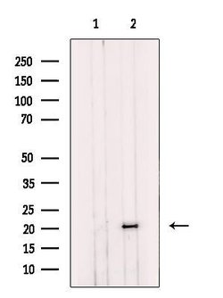 Invitrogen NDUFS7 Polyclonal Antibody 100 &mu;L; Unconjugated:Antibodies,