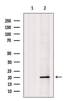 Invitrogen NDUFS7 Polyclonal Antibody 100 &mu;L; Unconjugated:Antibodies,