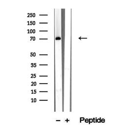Invitrogen RASGRP3 Polyclonal Antibody 100 μL; Unconjugated:Antibodies,