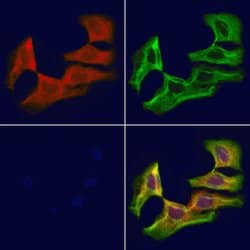 Invitrogen SACM1L Polyclonal Antibody 100 &mu;L; Unconjugated:Antibodies,