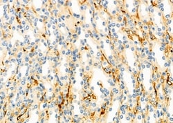 Invitrogen SACM1L Polyclonal Antibody 100 &mu;L; Unconjugated:Antibodies,