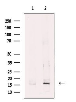 Invitrogen SH2D1B Polyclonal Antibody 100 &mu;L; Unconjugated:Antibodies,