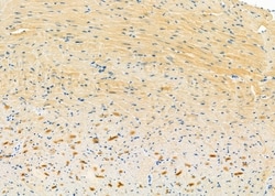 Invitrogen SH2D1B Polyclonal Antibody 100 &mu;L; Unconjugated:Antibodies,