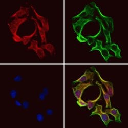 Invitrogen SLC38A3 Polyclonal Antibody 100 &mu;L | Buy Online | Invitrogen&trade; | Fisher Scientific