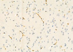 Invitrogen SLC38A3 Polyclonal Antibody 100 &mu;L | Buy Online | Invitrogen&trade; | Fisher Scientific