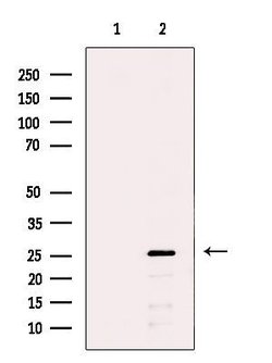 Invitrogen SNRPB2 Polyclonal Antibody 100 &mu;L; Unconjugated:Antibodies,