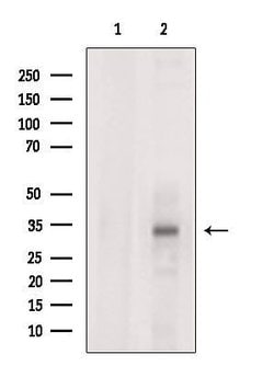 Invitrogen STC2 Polyclonal Antibody 100 &mu;L; Unconjugated:Antibodies,