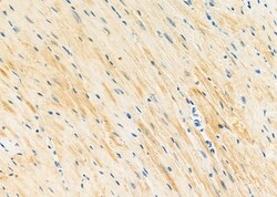 Invitrogen STX16 Polyclonal Antibody 100 μL; Unconjugated:Antibodies,