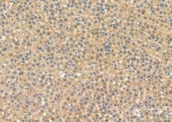 Invitrogen STX16 Polyclonal Antibody 100 μL; Unconjugated:Antibodies,