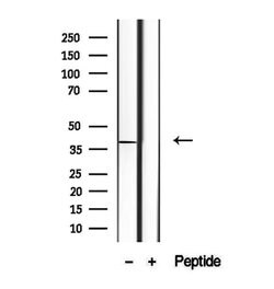 Invitrogen STX16 Polyclonal Antibody 100 μL; Unconjugated:Antibodies,