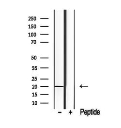 Invitrogen TIMM17B Polyclonal Antibody 100 &mu;L; Unconjugated:Antibodies,