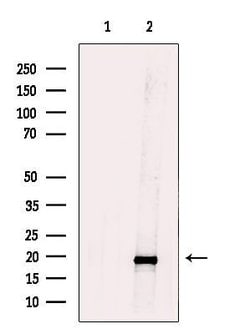 Invitrogen TIMM17B Polyclonal Antibody 100 &mu;L; Unconjugated:Antibodies,