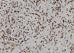 Invitrogen TRBP Polyclonal Antibody 100 &mu;L; Unconjugated:Antibodies,