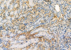 Invitrogen UQCRC2 Polyclonal Antibody 100 &mu;L; Unconjugated:Antibodies,