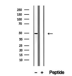 Invitrogen UQCRC2 Polyclonal Antibody 100 &mu;L; Unconjugated:Antibodies,