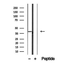 Invitrogen SLC22A12 Polyclonal Antibody 100 &mu;L | Buy Online | Invitrogen&trade; | Fisher Scientific