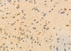 Invitrogen ALP Polyclonal Antibody 100 &mu;L; Unconjugated:Antibodies,