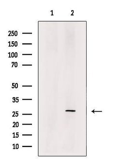 Invitrogen RTRAF Polyclonal Antibody 100 μL; Unconjugated:Antibodies,